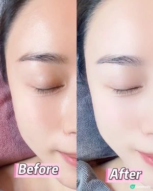 ✨ 【零痛感･瞬間小顏急救‼️】荃灣 WY Beauty ｢...