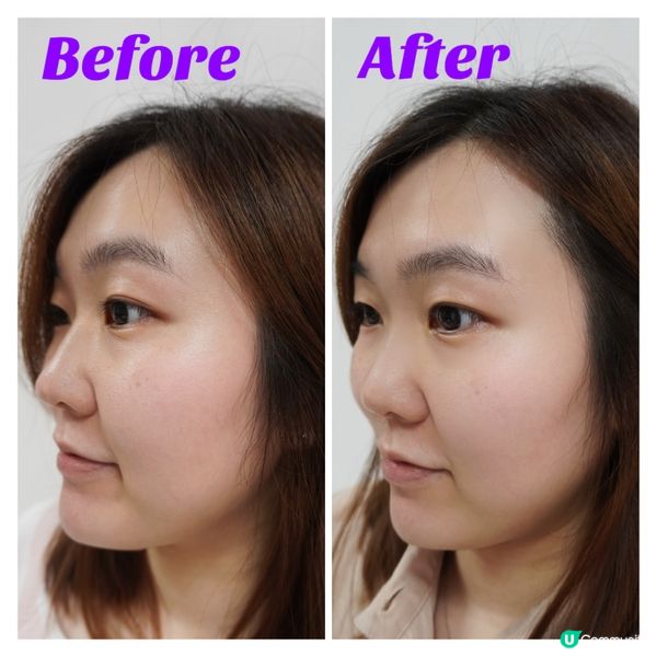 Exuviance 高效能家居煥膚組合AP25