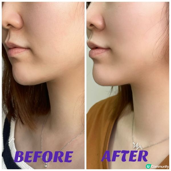 女神凍齡獨家秘訣｜重塑飽滿緊緻年輕美肌