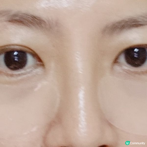 Mediheal 逆時抗皺撫紋凝膠眼膜