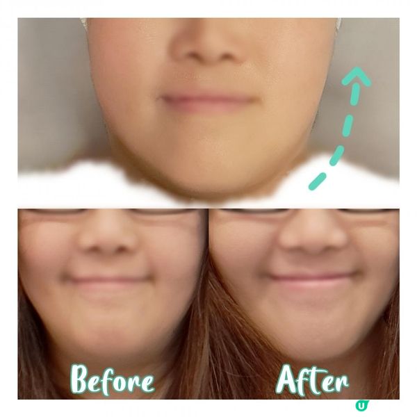 即時見效的瓷溫排毒瘦面療程