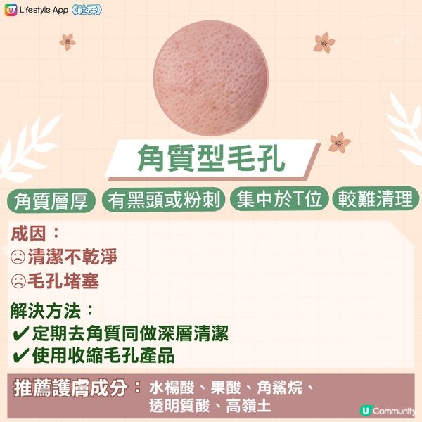 【急救粗大毛孔‼️】認清4大毛孔類型 x 針對性護膚