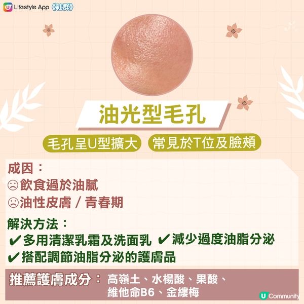 【急救粗大毛孔‼️】認清4大毛孔類型 x 針對性護膚