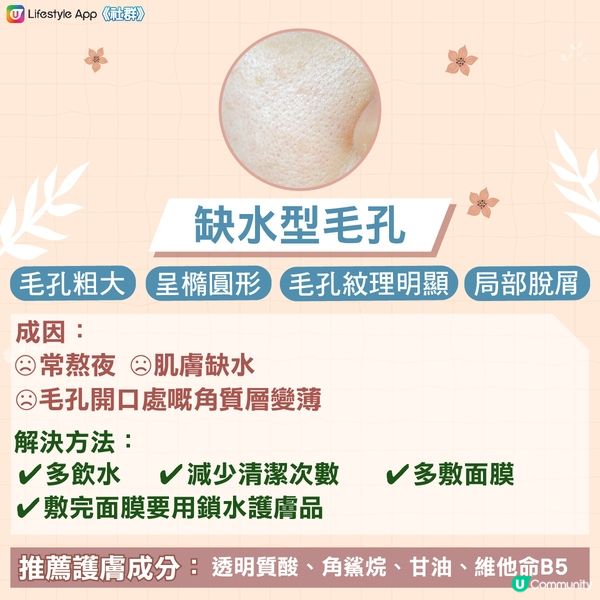 【急救粗大毛孔‼️】認清4大毛孔類型 x 針對性護膚