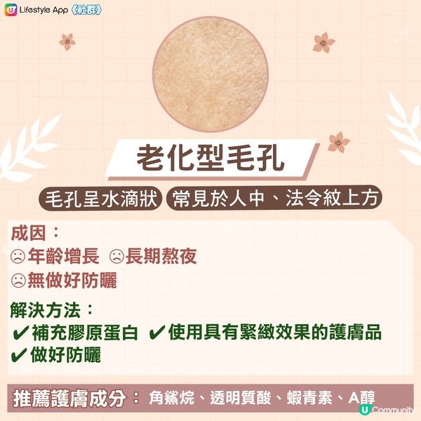 【急救粗大毛孔‼️】認清4大毛孔類型 x 針對性護膚