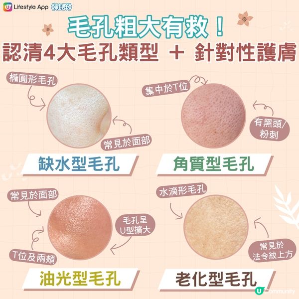 【急救粗大毛孔‼️】認清4大毛孔類型 x 針對性護膚