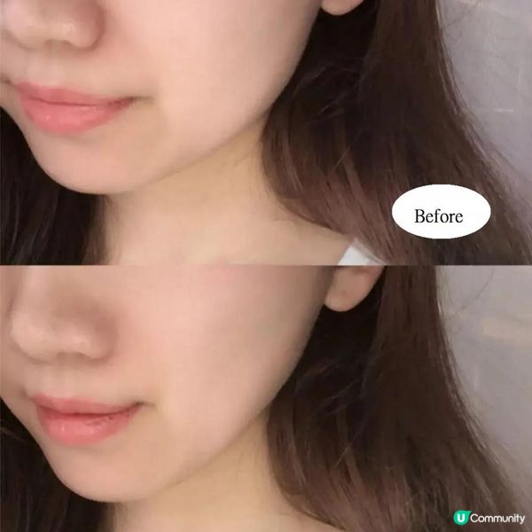 韓國版THERMAGE OLIGIO係乜東東?