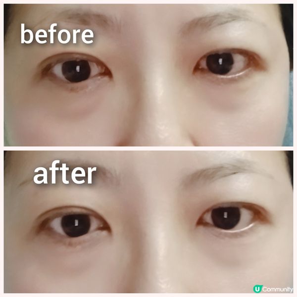 Orchid 口香糖去黑眼圈眼膜