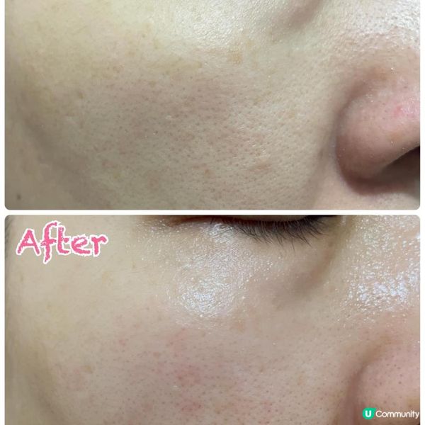 [試用] Lancôme Advanced Génifique 小黑瓶 – 急救修復。肌膚重返嫩滑亮