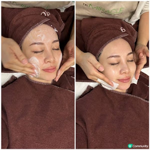 【實測】Dr. Miracle皮秒激光去斑療程效果分享～Dr. Miracle好唔好? 是否黑店?