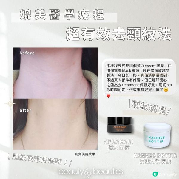 一條頸紋老10歲，1個月去頸紋，Afrakari彈力面霜+Hannes Dottir反重力緊膚膜