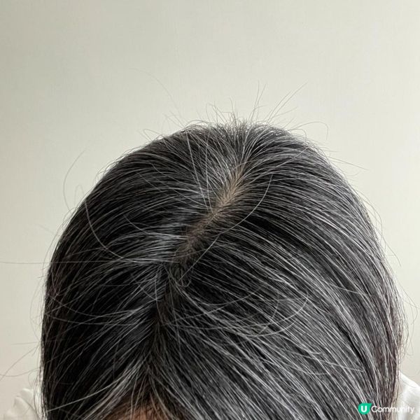 產後脱髮點算？Pilfood維佳活髮營養片