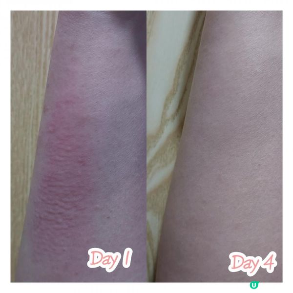 #樂道漢藥花煥膚舒 #肌膚保護膜 #濕疹止痕退紅超推介