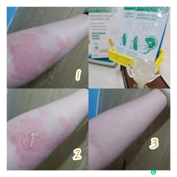 有鼻塞煩惱就可以用尚護健鼻舒貼