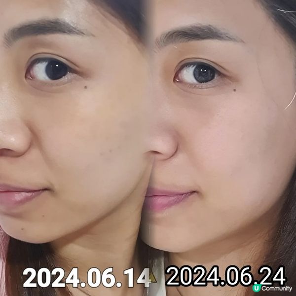 【好物推介🫸】Ulike白皇后美容儀