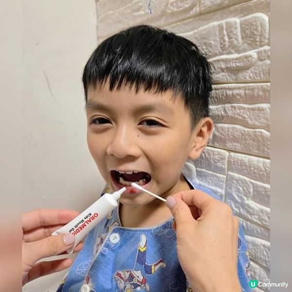 家中必備兒童口腔損傷萬用膏**口健樂 兒童痱滋啫喱