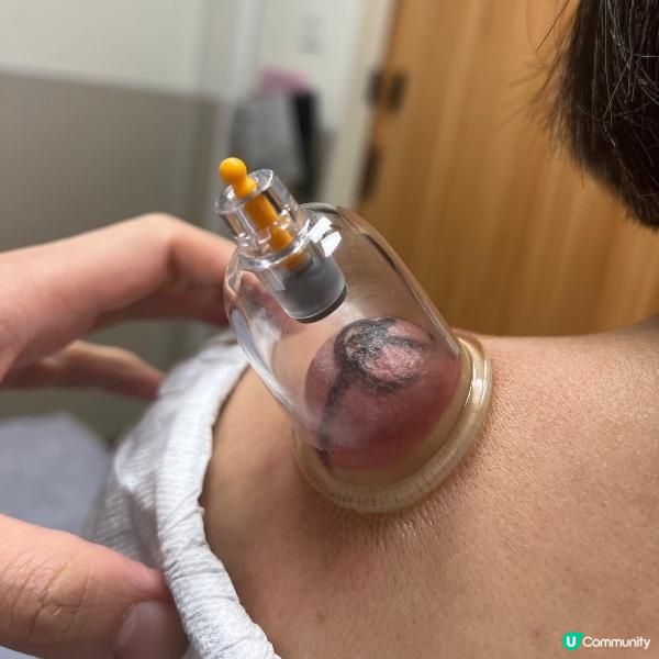 30分鐘治療痛症冇難度!