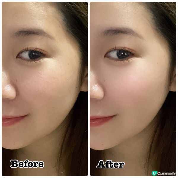 三重透明質酸B5精華