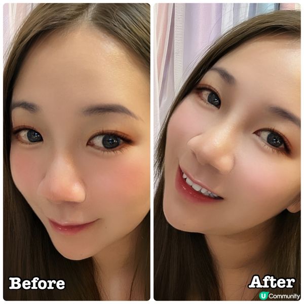 SOS 安敏舒護精華