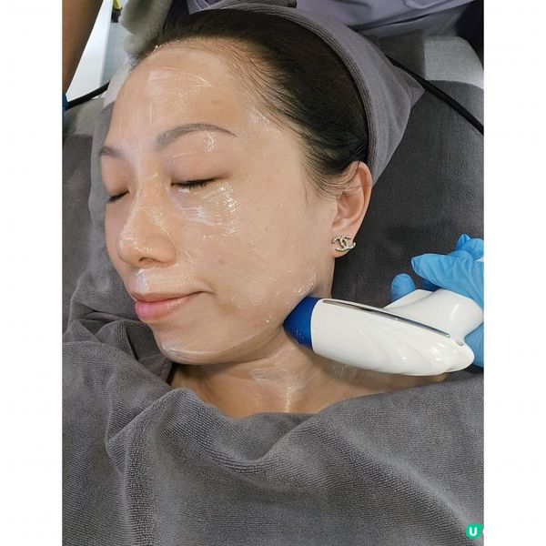 美容保養～膠原槍 ⭐️效果驚人