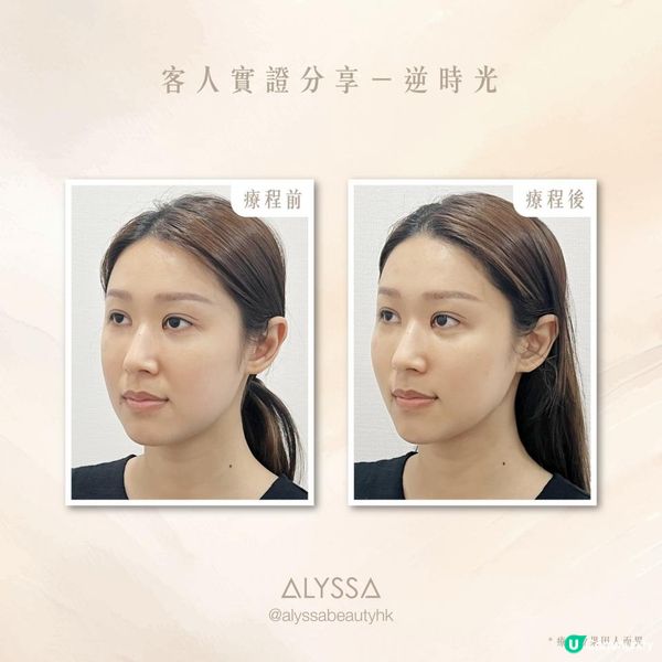 抗衰老的自然奇蹟 補充天然食物NMN可以逆齡？