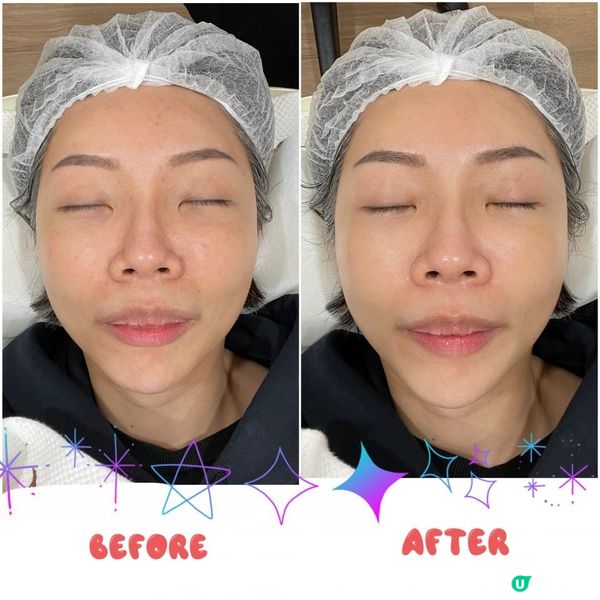 Modelage Stellar M22 升級版加強脈衝光美容儀