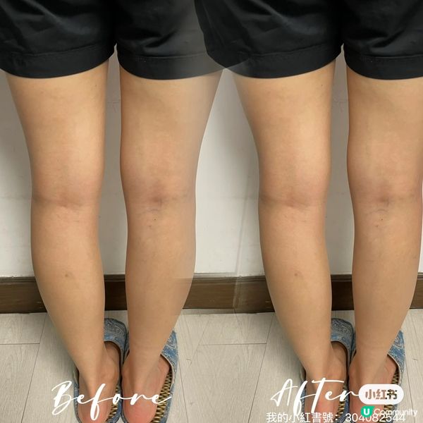 濕氣重腳腫？😭  粟米鬚茶幫到你！💪