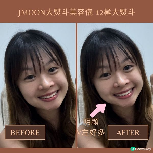 Jmoon首創12極超大熨斗頭 提拉緊致快3倍✨