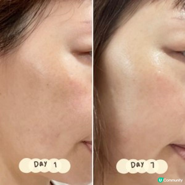 夏天為肌膚帶來黑色素😳 我要全部擊退！