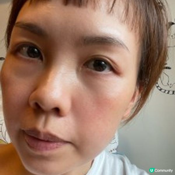 夏天為肌膚帶來黑色素😳 我要全部擊退！