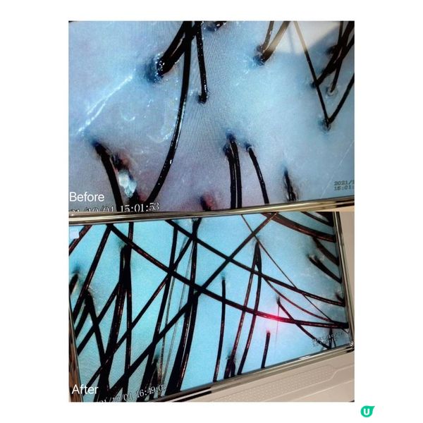 頭皮護理推介 Cupid Hair 髮比特活髮專家