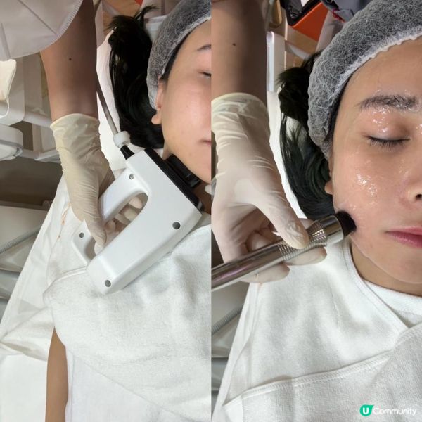 輕鬆瘦面！三種功效，INMODE一機搞掂 😍😍