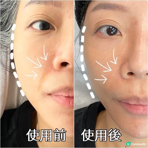 提升輪廓踢走雙下巴baby face ZIIP Halo