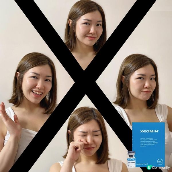 😝表情紋嘅出現