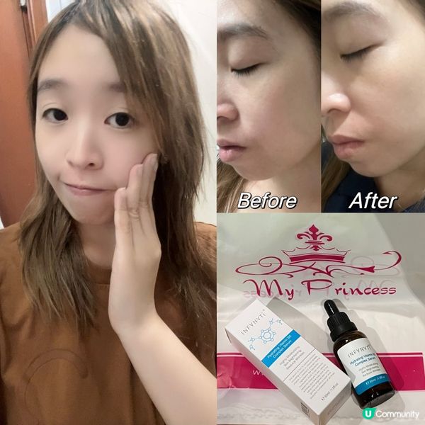 天氣轉變，敏感肌救星！ 💦