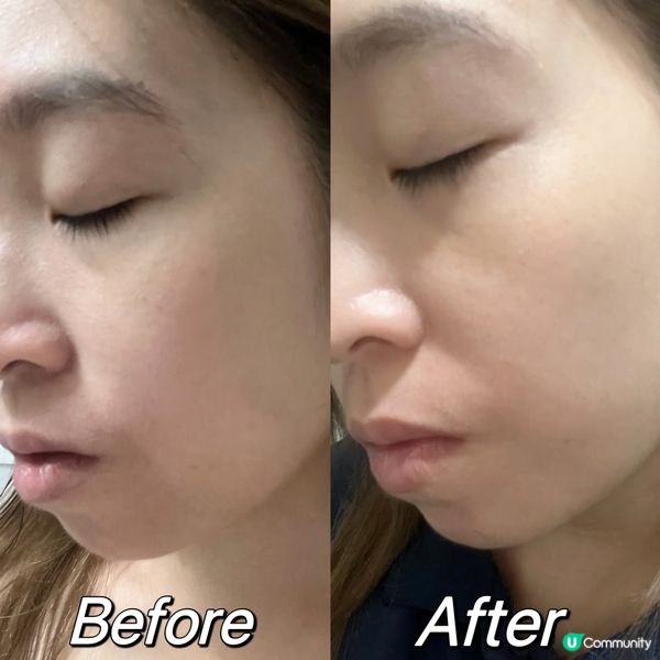 天氣轉變，敏感肌救星！ 💦