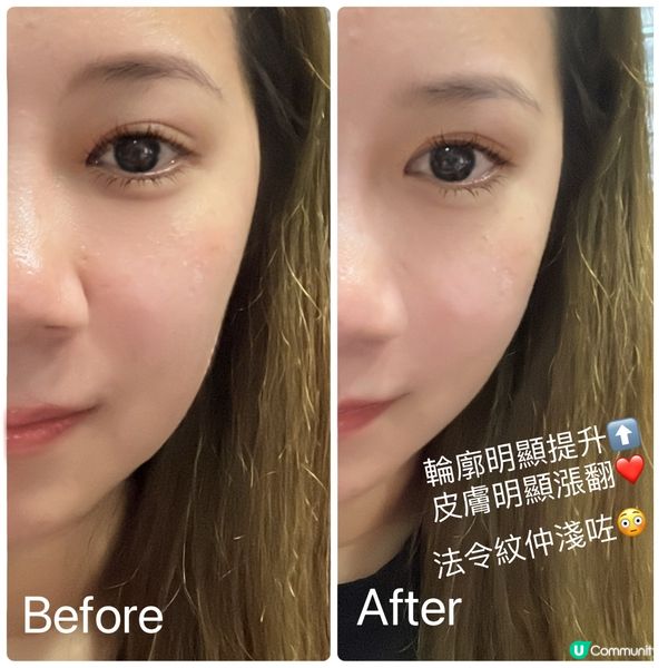 🇯🇵日本醫美品牌Spa treatment