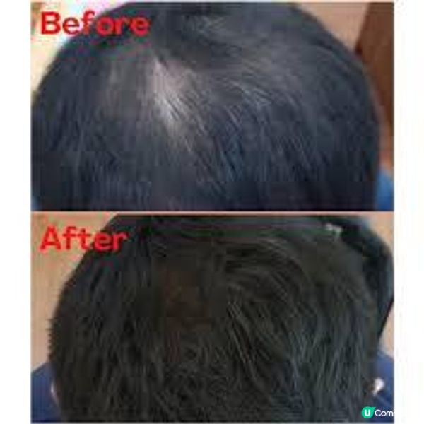 圓禿男士親測2種生髮服務：Hair Again 和 Perfect Men 性價比比一比，沒想到兩家都不是黑店，真的好冤枉被網友風評害慘了！