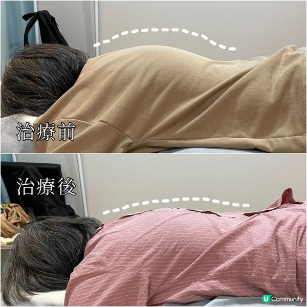 生完BB腰酸背痛？盤骨變寬係元兇！😱