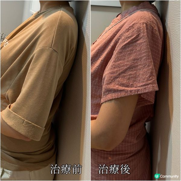 生完BB腰酸背痛？盤骨變寬係元兇！😱