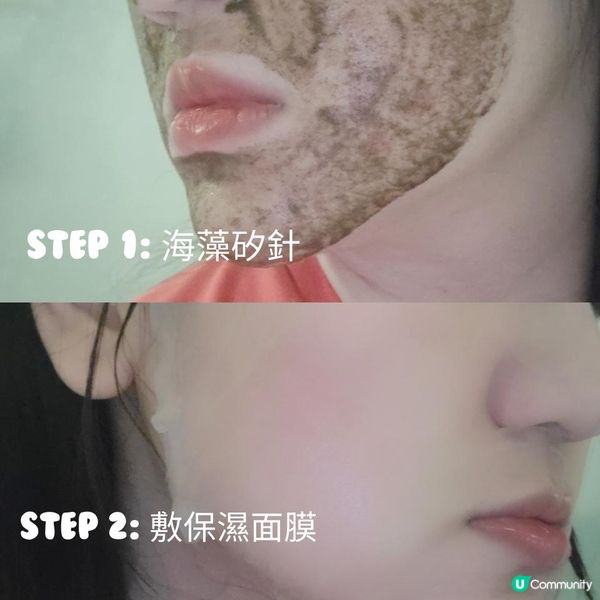 ✨️我的肌膚救星，告別肌膚煩惱🤗