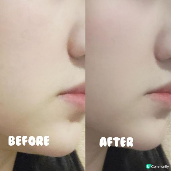 ✨️我的肌膚救星，告別肌膚煩惱🤗