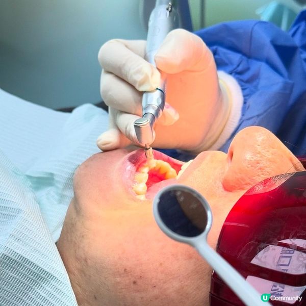 深圳松鼠口腔🦷  牙石剋星！😎