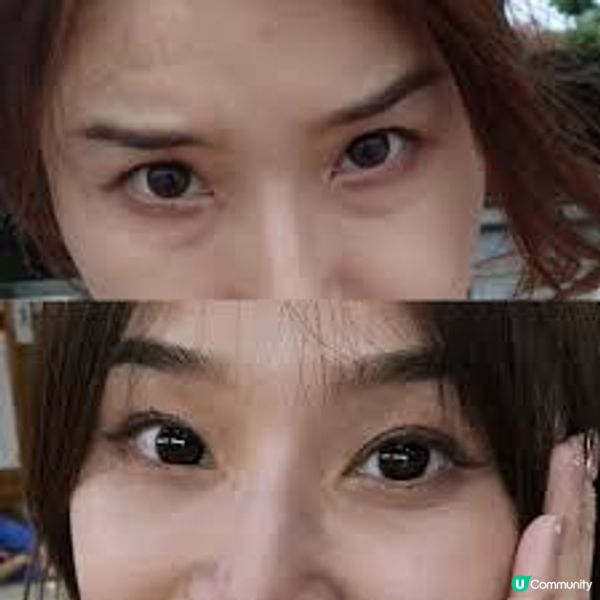 眼部疲勞生成眼袋與水腫跡象？親測2款緊緻眼周醫美療程：INGRID MILLET PARIS & New Beauty，這款去眼袋消水腫效果超出預期！