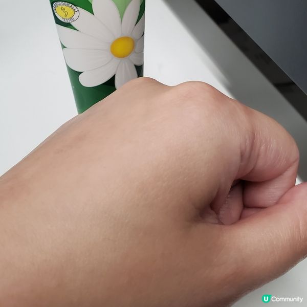 生完BB皮膚差？爛手乾痕？😭  德國小甘菊救你！🌼