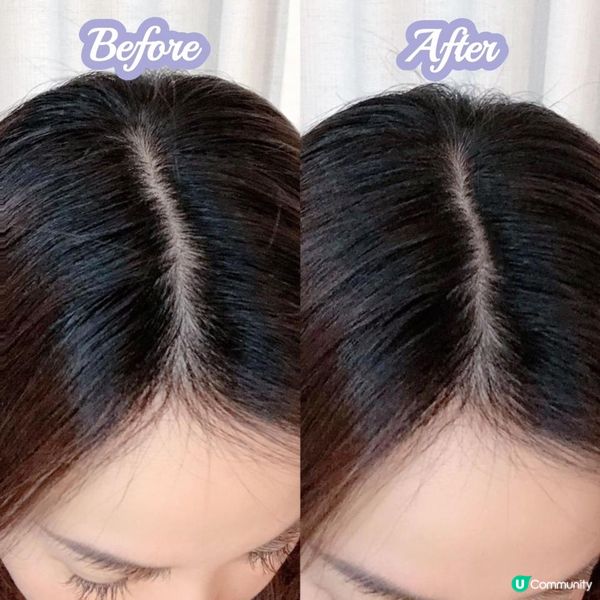 💚Yves Rocher皇牌No.1防脫育髮系列