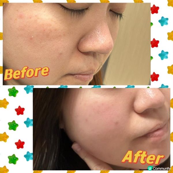 冬天係美白嘅好時機！⛄