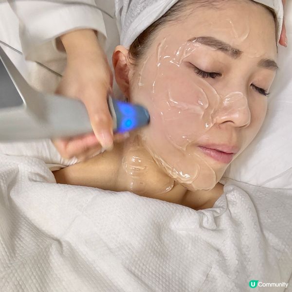 🌟25歲後救星 Ultra Shape R6 膠原槍