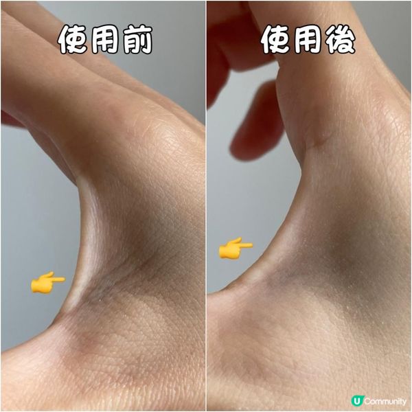 皺紋殺手ZINO紋立消