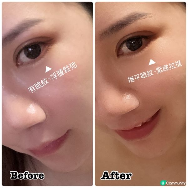 ❤️HAS exo 幹細胞蛇毒紅眼膜